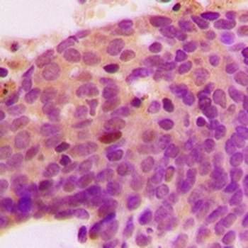 TM9SF1 Rabbit Polyclonal Antibody