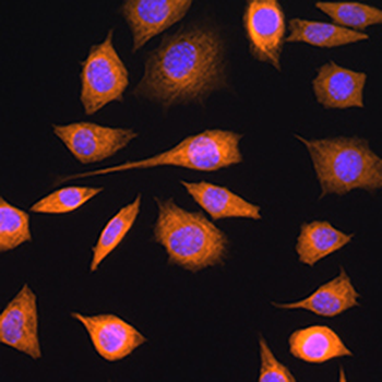 SOAT1 Rabbit Polyclonal Antibody