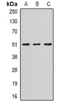 Serpin A10 Rabbit Polyclonal Antibody