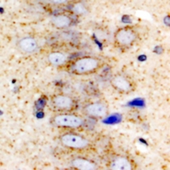 Serpin A10 Rabbit Polyclonal Antibody