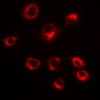 Serpin A10 Rabbit Polyclonal Antibody