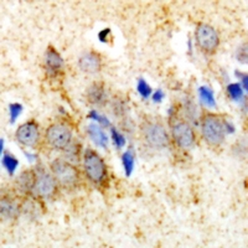 RUFY1 Rabbit Polyclonal Antibody