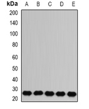RAB17 Rabbit Polyclonal Antibody