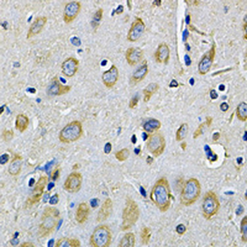 RAB17 Rabbit Polyclonal Antibody