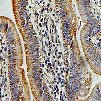 CD66f Rabbit Polyclonal Antibody