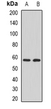 CALNA3 Rabbit Polyclonal Antibody