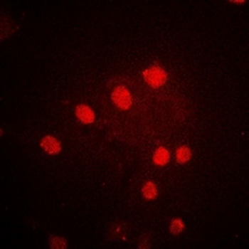 POLR1D Rabbit Polyclonal Antibody