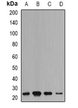 mPR Rabbit Polyclonal Antibody
