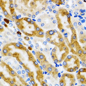 mPR Rabbit Polyclonal Antibody