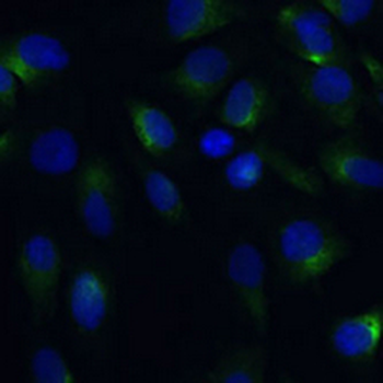 mPR Rabbit Polyclonal Antibody