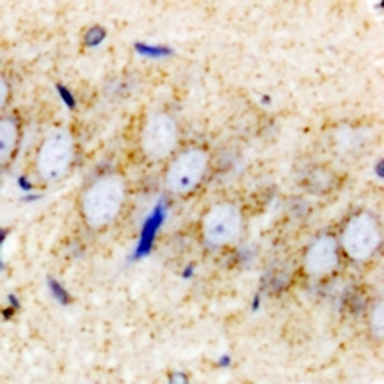 PENK Rabbit Polyclonal Antibody