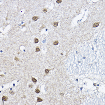 ORC6 Rabbit Polyclonal Antibody