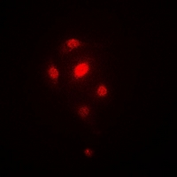 ORC6 Rabbit Polyclonal Antibody