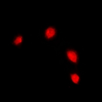 IFI16 Rabbit Polyclonal Antibody