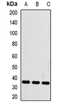 FRZB Rabbit Polyclonal Antibody