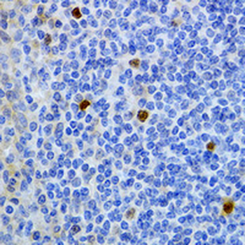 Ficolin 1 Rabbit Polyclonal Antibody