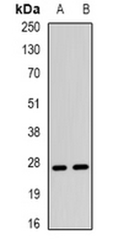 TSP1 Rabbit Polyclonal Antibody