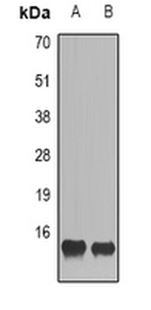 CCL28 Rabbit Polyclonal Antibody