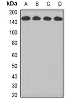CCAR1 Rabbit Polyclonal Antibody