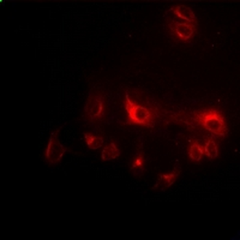 CCAR1 Rabbit Polyclonal Antibody