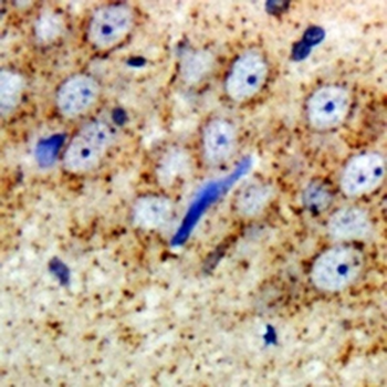 ARFGAP1 Rabbit Polyclonal Antibody