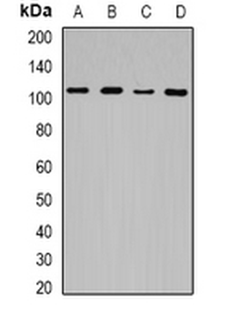 JHDM1D Rabbit Polyclonal Antibody