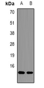 CGRP2 Rabbit Polyclonal Antibody