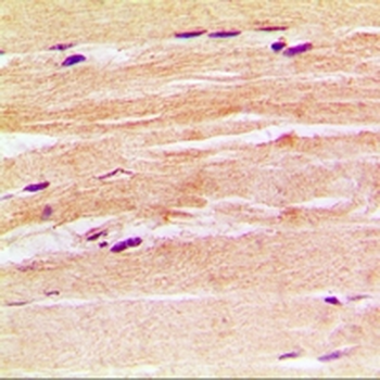 CGRP2 Rabbit Polyclonal Antibody