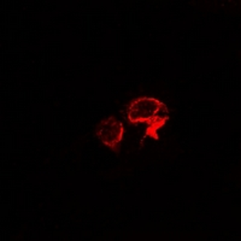 OSGEPL1 Rabbit Polyclonal Antibody