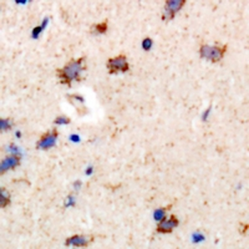 PIP4K2 beta Rabbit Polyclonal Antibody