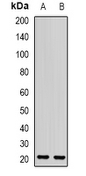 OPA3 Rabbit Polyclonal Antibody
