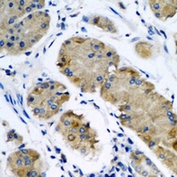 OPA3 Rabbit Polyclonal Antibody