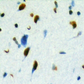 RUFY2 Rabbit Polyclonal Antibody