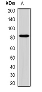 ZBTB20 Rabbit Polyclonal Antibody