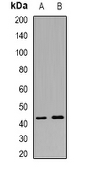CALHM1 Rabbit Polyclonal Antibody