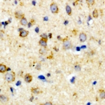 CALHM1 Rabbit Polyclonal Antibody
