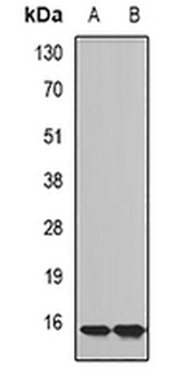 Complexin-2 Rabbit Polyclonal Antibody