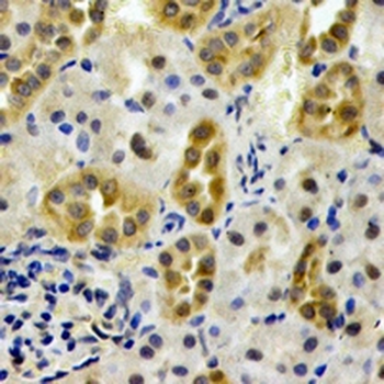 AHCYL1 Rabbit Polyclonal Antibody