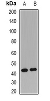 RCN2 Rabbit Polyclonal Antibody