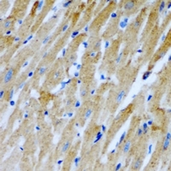 RCN2 Rabbit Polyclonal Antibody