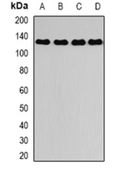 DAAM2 Rabbit Polyclonal Antibody