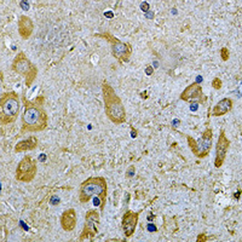 DAAM2 Rabbit Polyclonal Antibody