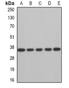 AUH Rabbit Polyclonal Antibody