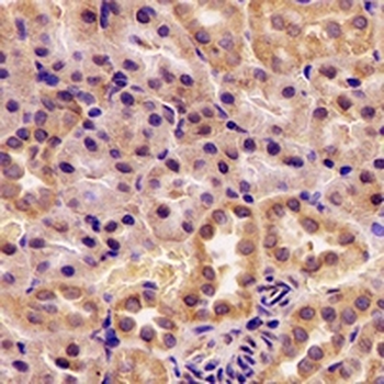 AUH Rabbit Polyclonal Antibody