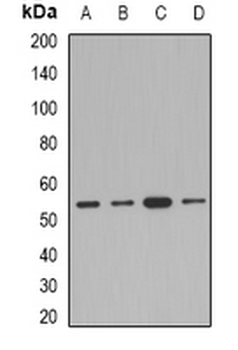 AEBP2 Rabbit Polyclonal Antibody
