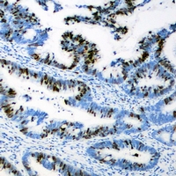 AEBP2 Rabbit Polyclonal Antibody