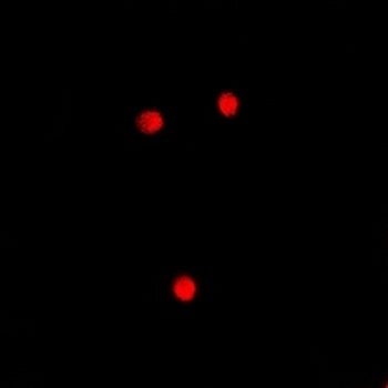AEBP2 Rabbit Polyclonal Antibody