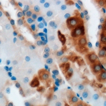 ERGIC2 Rabbit Polyclonal Antibody