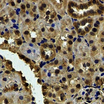 Karyopherin alpha-6 Rabbit Polyclonal Antibody