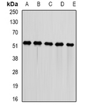 DNAJA3 Rabbit Polyclonal Antibody